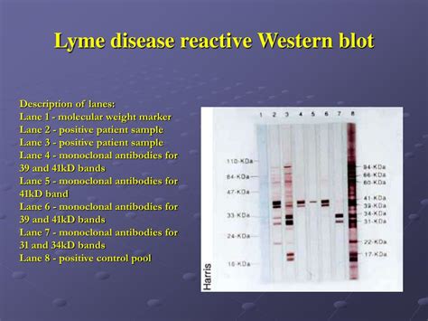 positive western blot test lyme